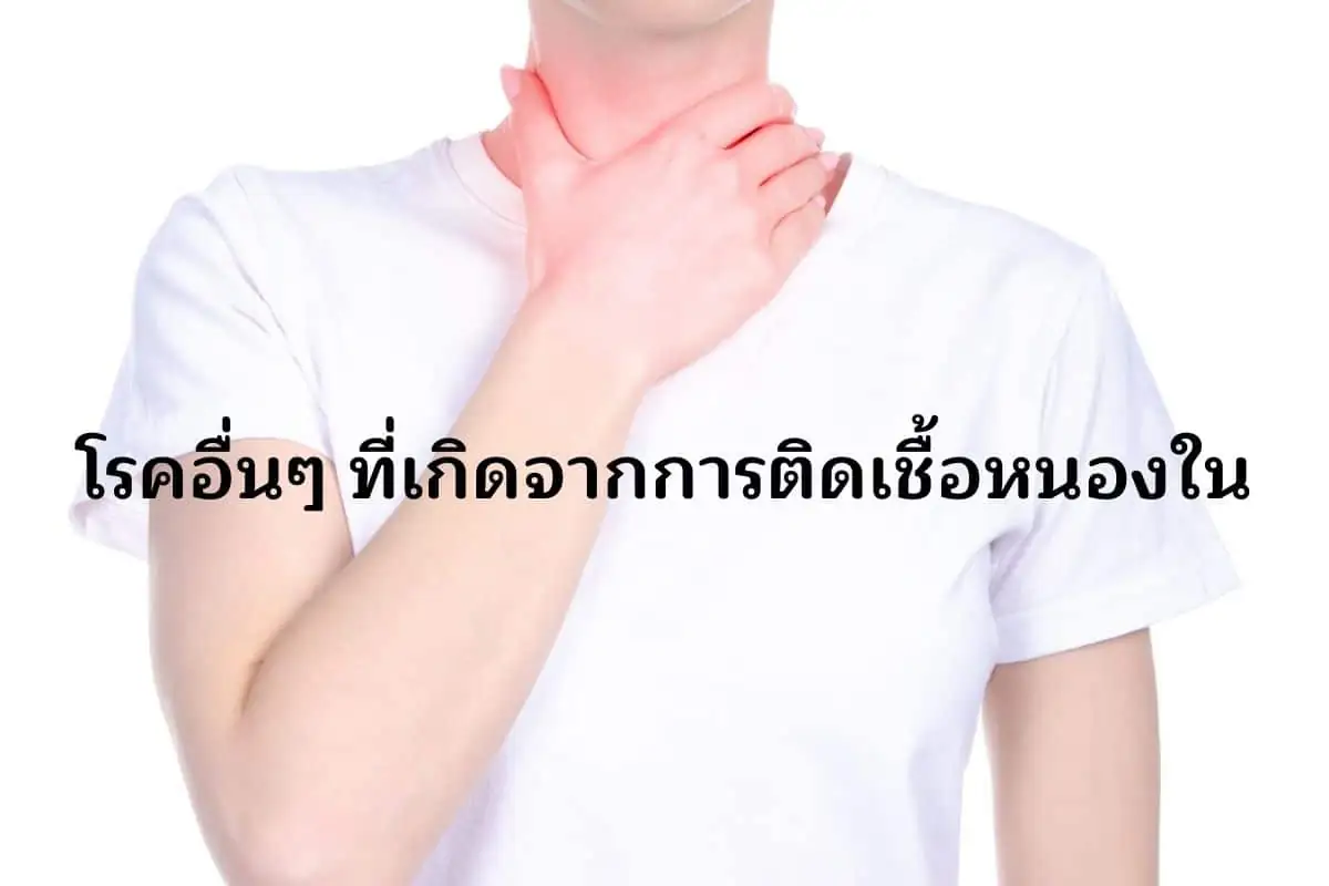 โรคอื่นๆ ที่เกิดจากการติดเชื้อหนองใน
