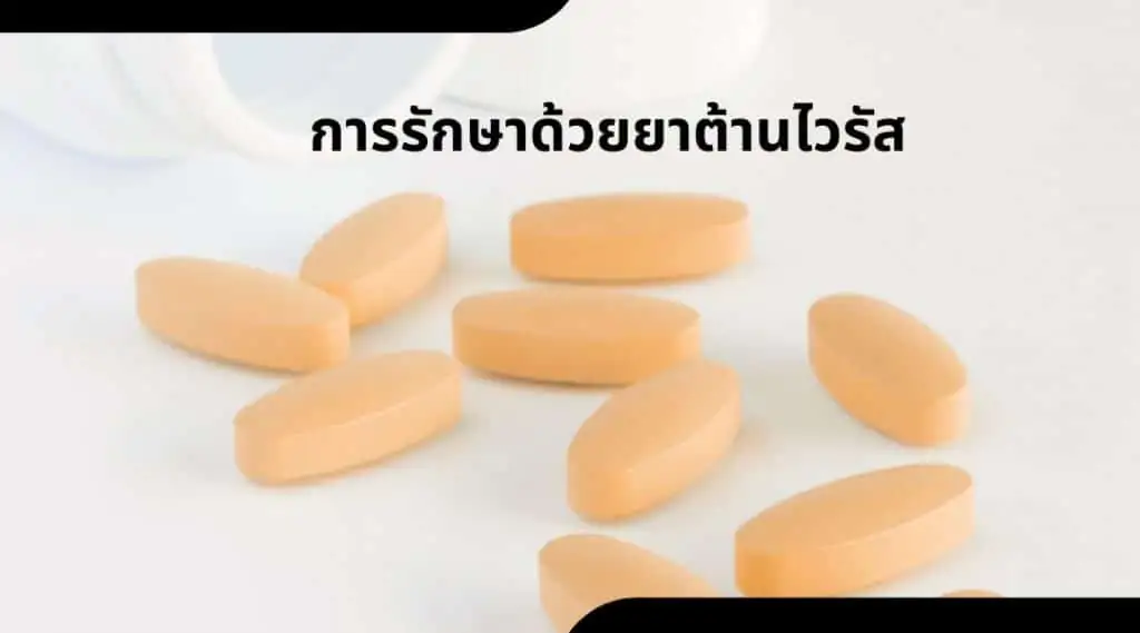 การรักษาด้วยยาต้านไวรัส