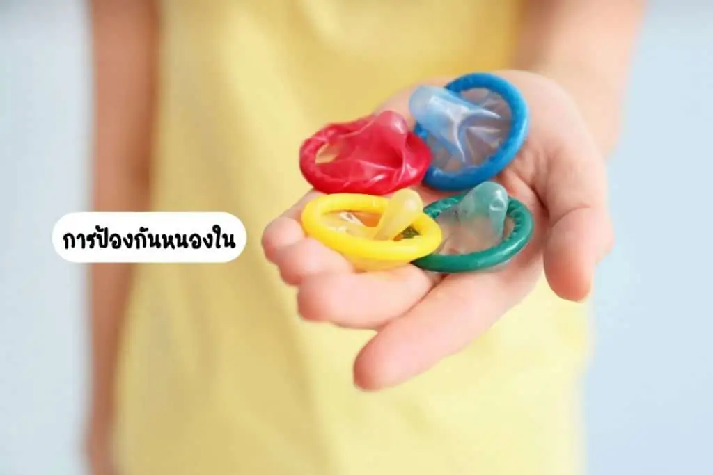 การป้องกันหนองใน